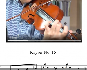 开塞15 – Kayser 15