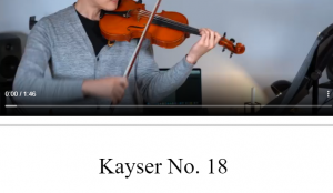 开塞18 – Kayser 18