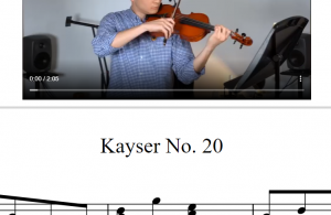 开塞20 – Kayser 20