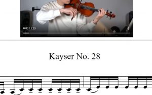 开塞28 – Kayser 28